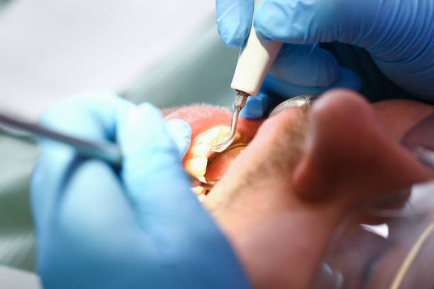 Best Emergency Treatment for Dental Infections or Abscesses in Taft Mosswood, CA