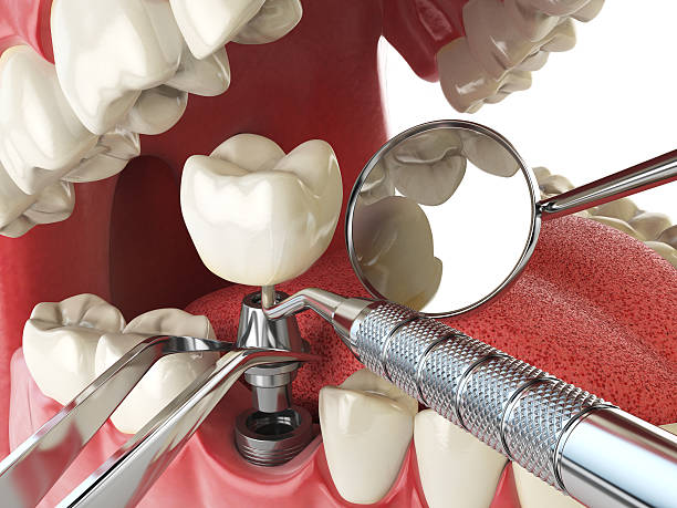 Best Emergency Gum Treatment in Taft Mosswood, CA